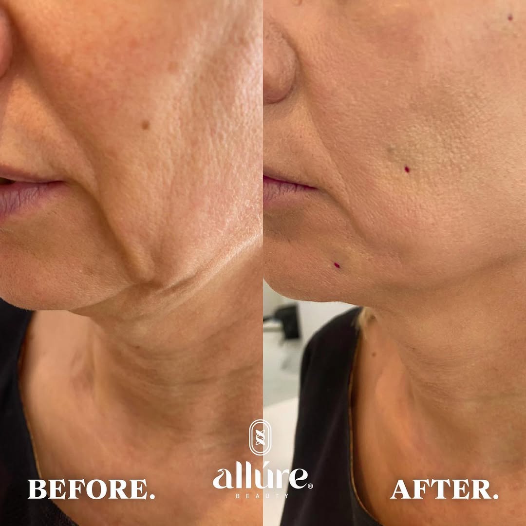 SnapInsta.to_240594455_814665502531536_4021368291326368455_n