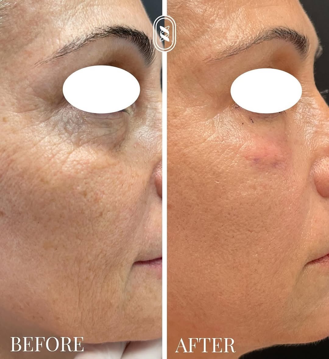 SnapInsta.to_483605884_18032955653625291_6353631150586421318_n